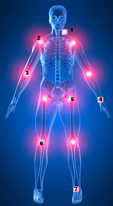 skeleton with highlighted joint pain