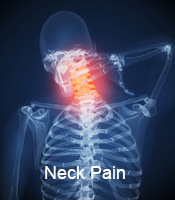 neck-pain-huntsville-al
